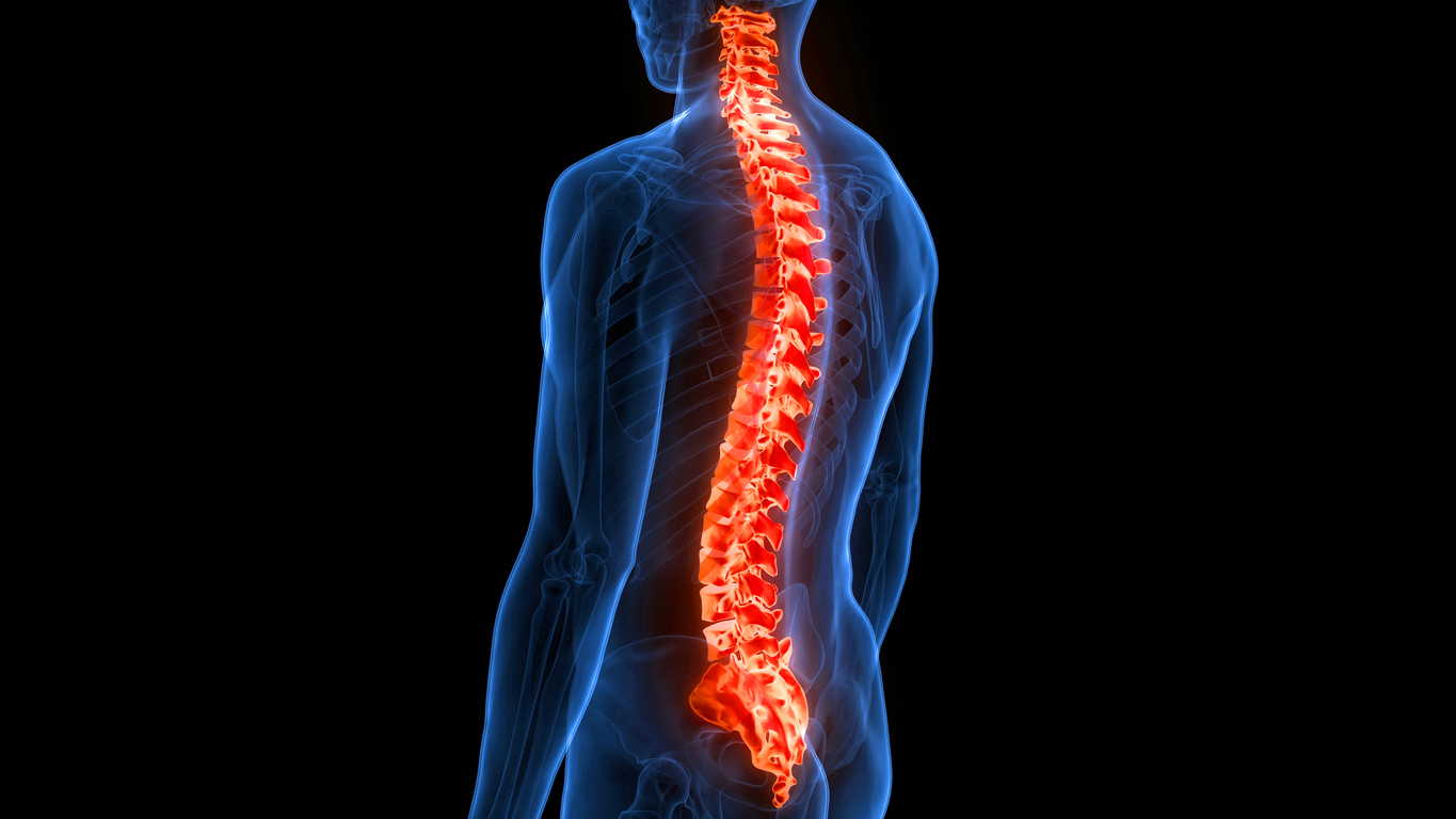 Facet Joint Arthropathy