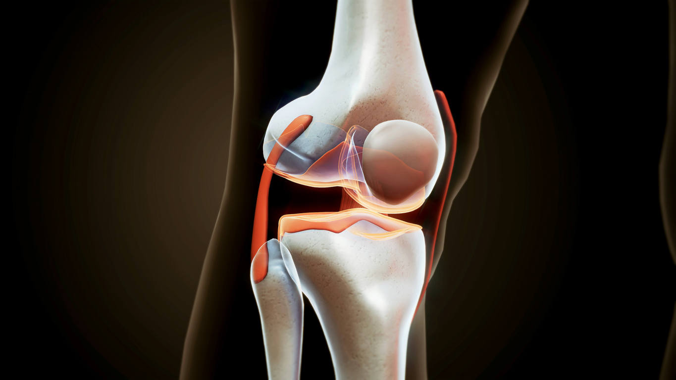 Osteoarthritis