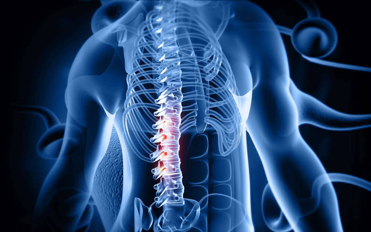 degenerative Disc Disease