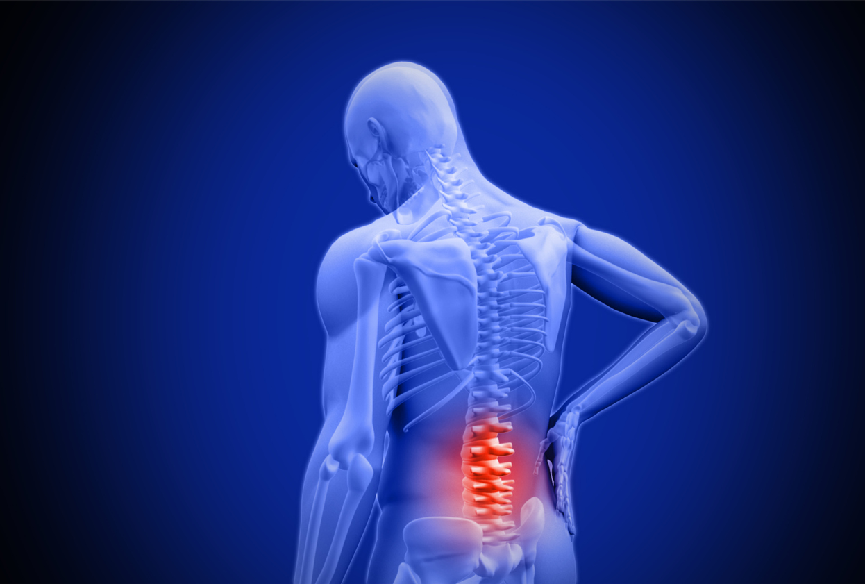 Lumbar post-surgery syndrome